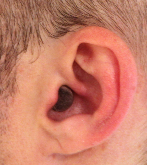 earplug cut and painted black in use