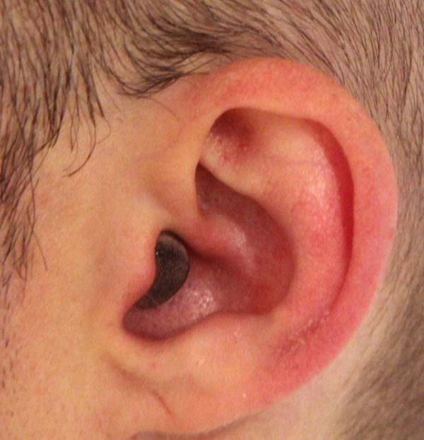 earplug cut and painted in use 2